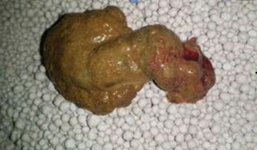 吃瓜藏屎,揭秘娱乐圈背后的真相与内幕